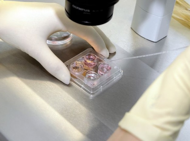 Искусственное оплодотворение (ЭКО) в центре репродуктологии Medicana